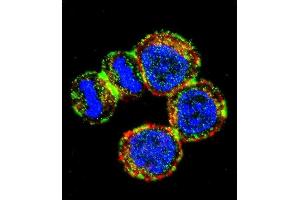 Confocal immunofluorescent analysis of BIRC3 Antibody (N-term) (ABIN657941 and ABIN2846885) with MDA-M cell followed by Alexa Fluor 488-conjugated goat anti-rabbit lgG (green). (BIRC3 抗体  (N-Term))