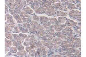 Immunohistochemistry (IHC) image for anti-N-Acetyltransferase 1 (Arylamine N-Acetyltransferase) (NAT1) (AA 9-254) antibody (ABIN7436222)