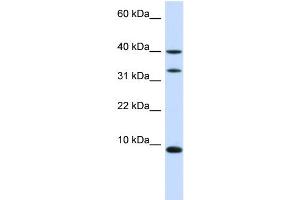 WB Suggested Anti-DBI Antibody Titration:  0. (Diazepam Binding Inhibitor 抗体  (N-Term))