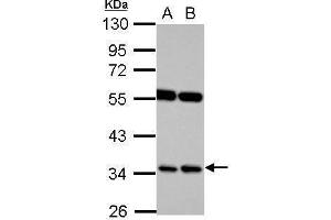 WB Image Sample (30 ug of whole cell lysate) A: Raji B: K562 10% SDS PAGE antibody diluted at 1:1000 (RASSF7 抗体  (Center))