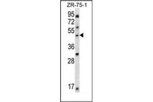 Western blot analysis of LDB1 Antibody (C-term) in ZR-75-1 cell line lysates (35ug/lane).