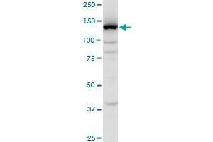FLJ39155 polyclonal antibody (A01), Lot # 051024JC01. (EGFLAM 抗体  (AA 914-1001))