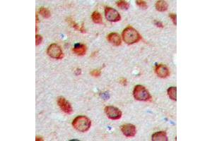 Immunohistochemistry (IHC) image for anti-Cytochrome P450, Family 2, Subfamily S, Polypeptide 1 (CYP2S1) (Center) antibody (ABIN7300598)