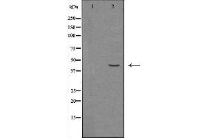Western blot analysis of Hela whole cell lysates, using HSD3B2 Antibody. (HSD3B2 抗体)