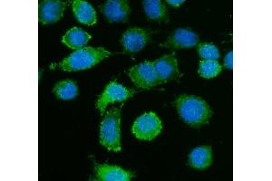 IF analysis of Caldesmon using anti-Caldesmon antibody (ABIN4886498). (Caldesmon 抗体  (AA 1-120))