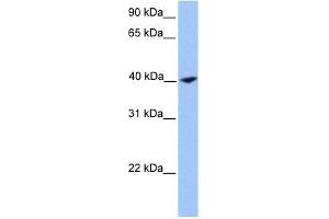 Calponin 2 antibody used at 1 ug/ml to detect target protein. (CNN2 抗体  (N-Term))