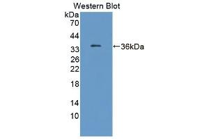 Detection of Recombinant TKT, Human using Polyclonal Antibody to Transketolase (TKT) (TKT 抗体  (AA 1-294))