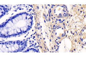 Immunohistochemistry (IHC) image for anti-Collagen, Type I, alpha 1 (COL1A1) (AA 253-471) antibody (ABIN7428014)
