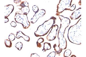 Formalin-fixed, paraffin-embedded human Placenta stained with hCG beta Mouse Monoclonal Antibody (HCGb/54). (CGB 抗体)