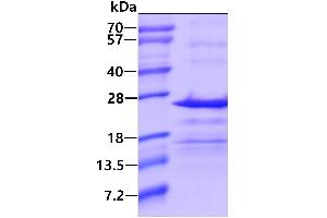 Chromosome 17 Open Reading Frame 49 (C17orf49) (AA 1-172) protein (His tag)