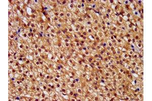 IHC image of ABIN7146392 diluted at 1:400 and staining in paraffin-embedded human adrenal gland tissue performed on a Leica BondTM system. (PNPLA8 抗体  (AA 158-345))