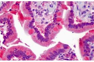 Human Small Intestine: Formalin-Fixed, Paraffin-Embedded (FFPE) (ZNF777 抗体  (AA 468-517))