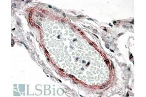 Immunohistochemistry (IHC) image for anti-Cysteine and Glycine-Rich Protein 2 (CSRP2) (Internal Region) antibody (ABIN238612)