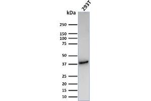 Western Blot Analysis of Human 293T cell lysate using CD74 Recombinant Rabbit Monoclonal Antibody (CLIP/3127R). (Recombinant CD74 抗体)