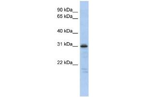 WB Suggested Anti-HOXD9 Antibody Titration:  0. (HOXD9 抗体  (Middle Region))