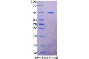 SDS-PAGE (SDS) image for Mucin 5 Subtype B (MUC5B) (AA 898-1002) protein (His tag,GST tag) (ABIN1980809)