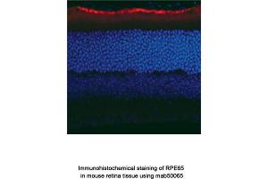 Image no. 2 for anti-Retinal Pigment Epithelium-Specific Protein 65kDa (RPE65) antibody (ABIN363219) (RPE65 抗体)