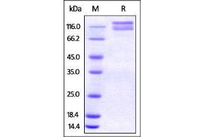 Human ITGAV & ITGB6 Heterodimer Protein on SDS-PAGE under reducing (R) condition. (ITGAV/ITGB6 Protein (AA 31-992) (His tag))