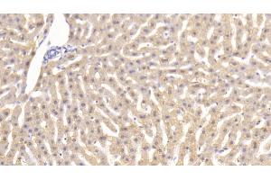 Detection of TNFa in Rabbit Liver Tissue using Monoclonal Antibody to Tumor Necrosis Factor Alpha (TNFa) (TNF alpha 抗体  (AA 80-235))