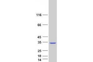 Western Blotting (WB) image for DiGeorge Syndrome Critical Region Gene 6-Like (DGCR6L) protein (Myc-DYKDDDDK Tag) (ABIN2719438)