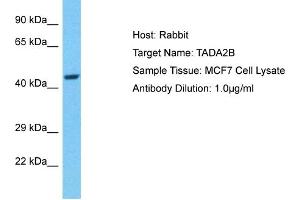 Host: Rabbit Target Name: TADA2B Sample Type: MCF7 Whole Cell lysates Antibody Dilution: 1. (TADA2B 抗体  (C-Term))