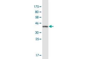 Western Blot detection against Immunogen (37. (HDHD1 抗体  (AA 107-212))