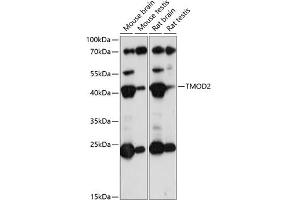 Western blot analysis of extracts of various cell lines, using TMOD2 antibody (ABIN7271012) at 1:1000 dilution. (TMOD2 抗体  (AA 120-200))