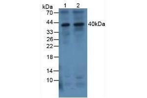 Western blot analysis of (1) Human 293T Cells and (2) Human Jurkat Cells. (IL-1 beta 抗体  (AA 117-268))