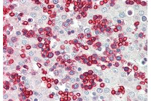 Rabbit Anti-ERMAP antibody  Formalin Fixed Paraffin Embedded Tissue: Human Fetal Liver Primary antibody Concentration: 1:100 Secondary Antibody: Donkey anti-Rabbit-Cy3 Secondary Antibody Concentration: 1:200 Magnification: 20x Exposure Time: 0. (ERMAP 抗体  (Middle Region))