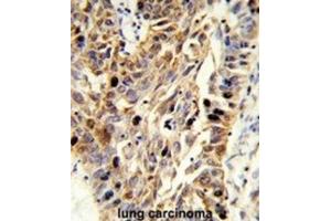 Immunohistochemistry (IHC) image for anti-Fibulin 3 (FBLN3) antibody (ABIN3004030) (FBLN3 抗体)
