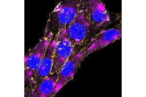 Expression of GFAP in rat C6 glioma cellsFixed and permeabilized cells were stained with Anti-GFAP-ATTO Fluor-647N Antibody (ABIN7582030), (1:200) and with CellMask Orange Actin tracking dye (yellow). (GFAP 抗体  (Intracellular) (Atto 647N))