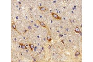 Immunohistochemistry (IHC) image for anti-Cannabinoid Receptor 2 (CNR2) (AA 329-356) antibody (ABIN3030275)