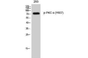 Western Blotting (WB) image for anti-Protein Kinase C, alpha (PKCa) (pTyr657) antibody (ABIN3182236) (PKC alpha 抗体  (pTyr657))