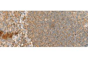 Immunohistochemistry of paraffin-embedded Human tonsil tissue using CD48 Polyclonal Antibody at dilution of 1:95(x200) (CD48 抗体)