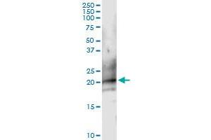 Immunoprecipitation of CD160 transfected lysate using anti-CD160 MaxPab rabbit polyclonal antibody and Protein A Magnetic Bead , and immunoblotted with CD160 purified MaxPab mouse polyclonal antibody (B01P) . (CD160 抗体  (AA 1-181))