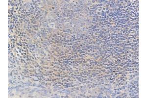 ABIN6258276 and ABIN6274540 at 1/100 staining human normal tonsil tissue by IHC-P. (MLX 抗体  (Internal Region))