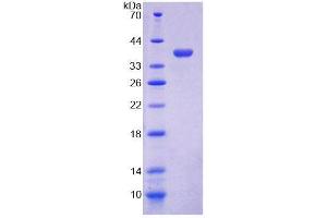 SDS-PAGE analysis of Mouse COX6c Protein. (COX6C 蛋白)