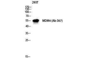 Western Blotting (WB) image for anti-Mdm4-binding Protein (MDM4) (Ser885) antibody (ABIN3185504) (MDM4-binding Protein 抗体  (Ser885))