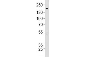 TSC2 antibody western blot analysis in 293 lysate. (Tuberin 抗体  (AA 1397-1426))