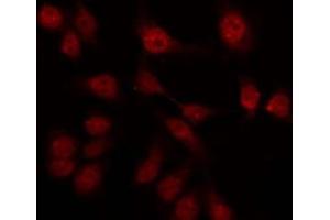 ABIN6276038 staining LOVO by IF/ICC. (GPR75 抗体  (Internal Region))