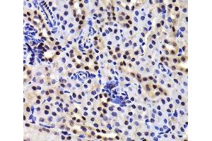 Immunohistochemistry of paraffin-embedded Mouse kidney using GABPB1 Polyclonal Antibody at dilution of 1:100 (40x lens).