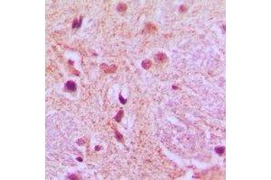 Immunohistochemical analysis of AGFG1 staining in human brain formalin fixed paraffin embedded tissue section. (AGFG1 抗体)