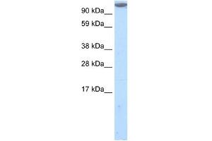 Western Blot showing MKL1 antibody used at a concentration of 1-2 ug/ml to detect its target protein. (MKL1 抗体  (C-Term))