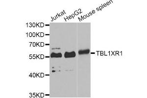 Western blot analysis of extracts of various cell lines, using TBL1XR1 Antibody (ABIN5975754) at 1/1000 dilution. (TBL1XR1 抗体)