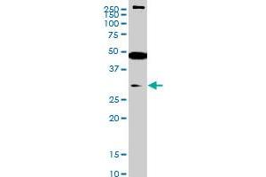 Western Blotting (WB) image for anti-SET Domain Containing (Lysine Methyltransferase) 7 (SETD7) (AA 257-366) antibody (ABIN566461)