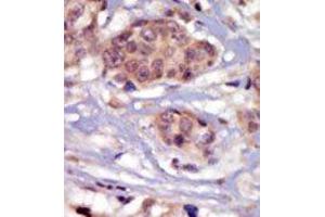 Image no. 1 for anti-FYN Oncogene Related To SRC, FGR, YES (FYN) (N-Term) antibody (ABIN359983) (FYN 抗体  (N-Term))