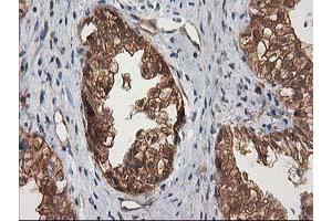 Image no. 7 for anti-Destrin (Actin Depolymerizing Factor) (DSTN) antibody (ABIN1497910) (Destrin 抗体)