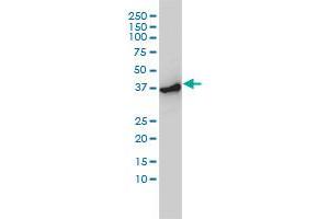 Western Blotting (WB) image for anti-Actin-Related Protein 2 (ACTR2) (AA 1-395) antibody (ABIN599116) (ACTR2 抗体  (AA 1-395))