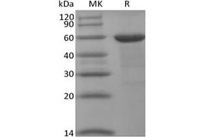 Western Blotting (WB) image for Bromodomain Containing 4 (BRD4) protein (ABIN7319875) (BRD4 蛋白)