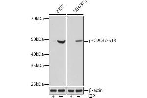 Western Blotting (WB) image for anti-Cell Division Cycle 37 Homolog (S. Cerevisiae) (CDC37) (pSer13) antibody (ABIN7266254)